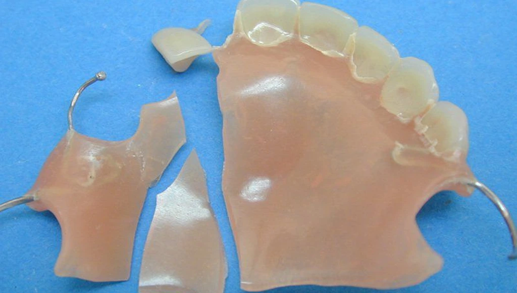 repraciones rápidas de prótesis en Palencia